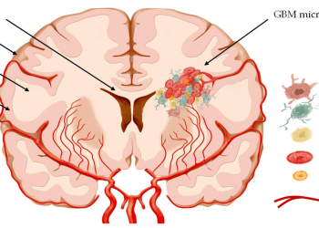 Ultimate guide to nanomedicines for the treatment of glioblastoma