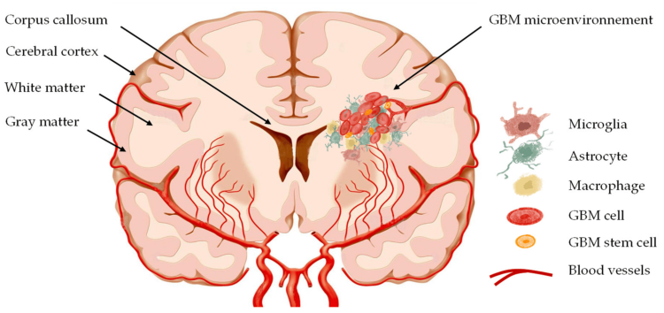Ultimate guide to nanomedicines for the treatment of glioblastoma