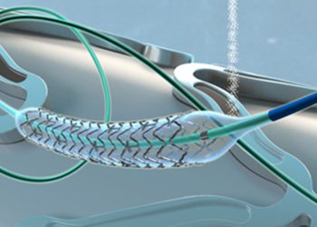Neurovascular Coupling Variability Across Human Lifespans: Why Some Brains Age Better Than Others